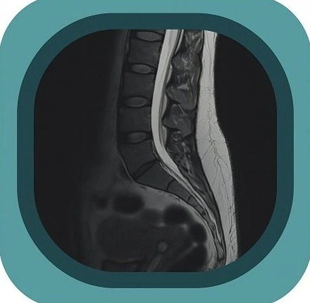 MRI L spine anatomy icon-1771191824